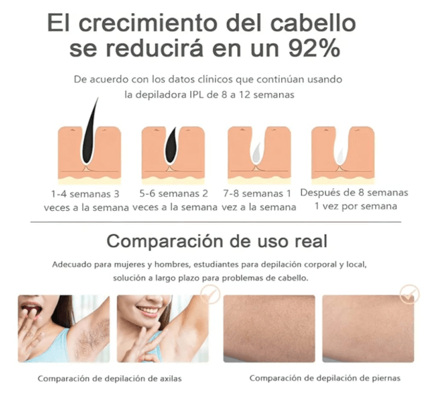 DEPILADORA LASER IPL - Imagen 3
